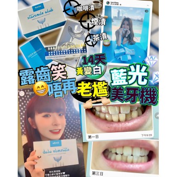 【美白牙齒機】StarSmileClub美國藍光美白牙齒機